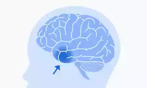 Frammento di cervello umano sano (1 mm³) prelevato dalla corteccia temporale anteriore sinistra durante un intervento chirurgico su una donna di 45 anni con epilessia. Utilizzato per accedere all'area sottostante una lesione dell’ippocampo. Il lobo temporale elabora i segnali sensoriali.